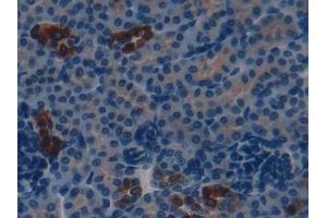 Detection of S100A8 in Mouse Kidney Tissue using Polyclonal Antibody to S100 Calcium Binding Protein A8 (S100A8)