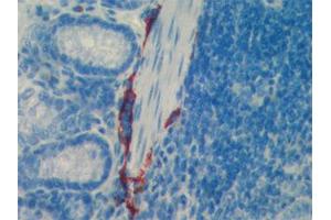 Immunohistochemistry detection of endogenous LYVE-1 in paraffin-embedded sections of mouse intestine using anti-LYVE-1), pAb  (red staining of lymphatic endothelial intestine cells). (LYVE1 antibody  (AA 24-228))