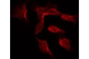 ABIN6266902 staining Hela by IF/ICC. (DGKH antibody  (Internal Region))