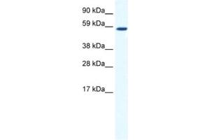 Western Blotting (WB) image for anti-TATA Box Binding Protein (TBP)-Associated Factor, RNA Polymerase I, B, 63kDa (TAF1B) antibody (ABIN2461499)