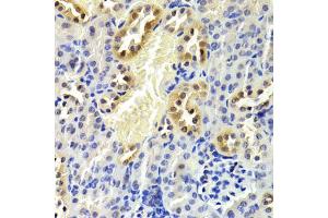 Immunohistochemistry of paraffin-embedded mouse kidney using CDKN1B Antibody. (CDKN1B antibody)