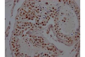 IHC image of ABIN7127590 diluted at 1:100 and staining in paraffin-embedded human testis tissue performed on a Leica BondTM system. (Recombinant LSD1 antibody)