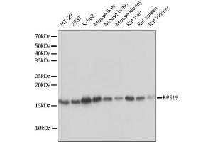 Western blot analysis of extracts of various cell lines, using RPS19 Rabbit mAb (ABIN1681275, ABIN3017969, ABIN3017970 and ABIN7101552) at 1:1000 dilution. (RPS19 antibody)