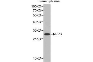 Western Blotting (WB) image for anti-Natriuretic Peptides B (NPPB) (AA 1-134) antibody (ABIN3023136) (NPPB antibody  (AA 1-134))