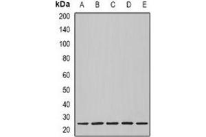 Western blot analysis of Nop30 expression in BT474 (A), MCF7 (B), mouse heart (C), mouse lung (D), rat heart (E) whole cell lysates.