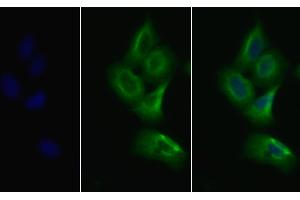 Detection of VEGFR2 in Human MCF7 cell using Polyclonal Antibody to Vascular Endothelial Growth Factor Receptor 2 (VEGFR2) (VEGFR2/CD309 antibody  (AA 46-320))