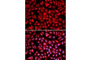 Immunofluorescence analysis of U2OS cells using IPO5 antibody. (Importin 5 antibody  (AA 20-300))