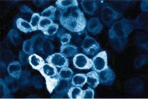 Immunofluorescent staining of A431 cells. (C-Raf-1 (AA 162-378) antibody)