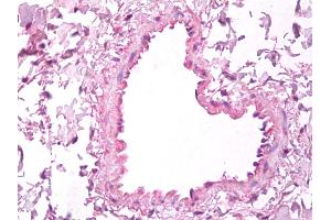 Anti-VEGF antibody IHC of human lung, vascular endothelium. (VEGFA antibody)