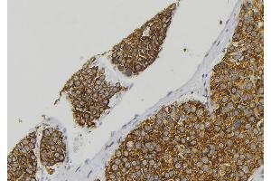 ABIN6278430 at 1/100 staining Human pancreas tissue by IHC-P. (CGRP antibody  (Internal Region))