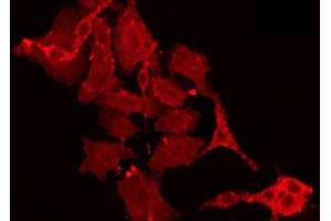 ABIN6266890 staining HT29 by IF/ICC. (MLK4 antibody)