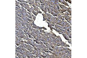 IHC analysis of EGFR using anti-EGFR antibody (ABIN7600915). (EGFR antibody  (AA 25-596))