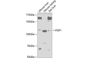 Western blot analysis of extracts of various cell lines, using POP1 antibody (ABIN6133335, ABIN6145961, ABIN6145962 and ABIN6221643) at 1:1000 dilution.