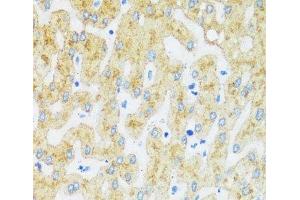 Immunohistochemistry of paraffin-embedded Human liver using ASGR1 Polyclonal Antibody at dilution of 1:100 (40x lens). (Asialoglycoprotein Receptor 1 antibody)