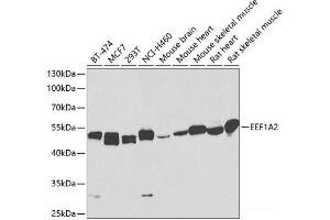 Western blot analysis of extracts of various cell lines using EEF1A2 Polyclonal Antibody at dilution of 1:1000. (EEF1A2 antibody)