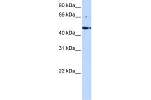 WB Suggested Anti-LYK5 Antibody Titration:  0. (STRADA antibody  (C-Term))