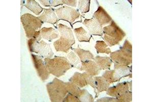 CDKN2C antibody immunohistochemistry analysis in formalin fixed and paraffin embedded human skeletal muscle.