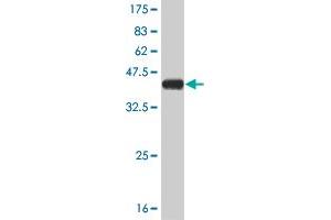 Western Blot detection against Immunogen (37. (STMN2 antibody  (AA 73-179))