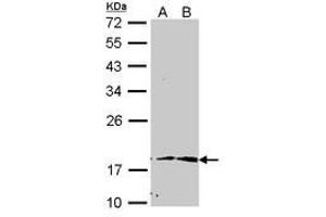 Image no. 1 for anti-Peptidylprolyl Cis/trans Isomerase, NIMA-Interacting 1 (PIN1) (AA 1-133) antibody (ABIN467591) (PIN1 antibody  (AA 1-133))