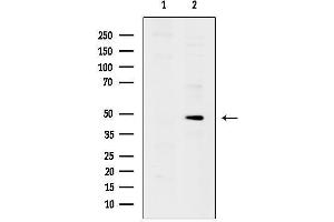 Western blot analysis of lysates from UV treated MCF7 cells, using Phospho-Keratin 17 (Ser44) Antibody.