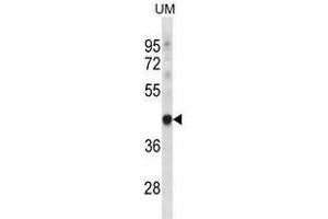 TRUB1 Antibody (Center) western blot analysis in UM cell line lysates (35 µg/lane). (TRUB1 antibody  (Middle Region))