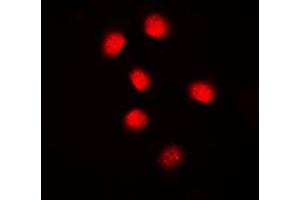 Immunofluorescent analysis of Cyclin E1 staining in MCF7 cells. (Cyclin E1 antibody  (C-Term))