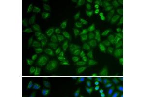 Immunofluorescence analysis of HeLa cells using SMPD1 / ASM Polyclonal Antibody (SMPD1 antibody)