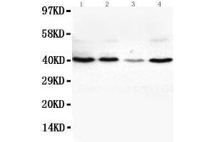 Anti-VEGFD antibody, Western blotting Lane 1: SW620 Cell Lysate Lane 2: COLO320 Cell Lysate Lane 3: 6T-CEM Cell Lysate Lane 4:  Cell Lysate