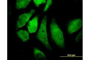 Image no. 2 for anti-conserved Helix-Loop-Helix Ubiquitous Kinase (CHUK) (AA 646-745) antibody (ABIN598612) (IKK alpha antibody  (AA 646-745))