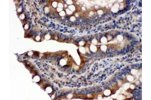 IHC testing of FFPE rat intestine with POR antibody.