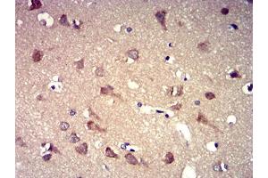 Immunohistochemical analysis of paraffin-embedded brain tissues using P2RY8 mouse mAb with DAB staining. (P2RY8 antibody)