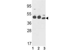 Western Blotting (WB) image for anti-Keratin 18 (KRT18) (AA 401-430) antibody (ABIN3031537)