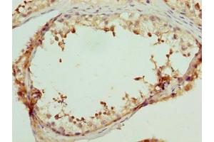 Immunohistochemistry of paraffin-embedded human testis tissue using ABIN7158142 at dilution of 1:100 (LRRC18 antibody  (AA 1-261))