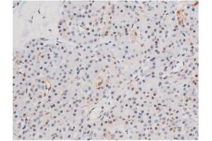 ABIN6267555 at 1/200 staining Human pancreas tissue sections by IHC-P. (LIMK2 antibody  (pSer283))