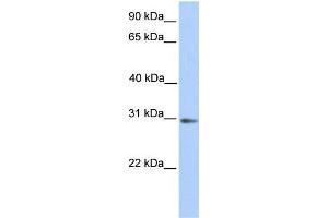 Human Placenta; WB Suggested Anti-ABHD13 Antibody Titration: 0. (ABHD13 antibody  (N-Term))