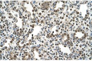 Human Lung (OSBPL9 antibody  (N-Term))