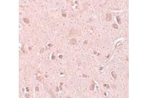 Immunohistochemistry (IHC) image for anti-NSA2 Ribosome Biogenesis Homolog (NSA2) (C-Term) antibody (ABIN1030737) (NSA2 antibody  (C-Term))
