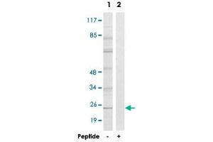 Western blot analysis of extracts from HT-29 cells, using GJB7 polyclonal antibody .