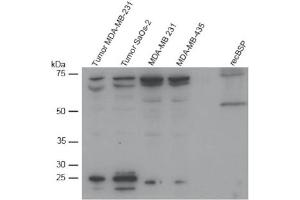 Western Blot analysis of BSP expression in different cell lines. (BSP antibody  (AA 201-211))