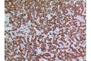 Immunohistochemical analysis of paraffin-embedded human-liver, antibody was diluted at 1:100. (APAF1 antibody  (Internal Region))