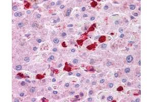 LRRC8B antibody was used for immunohistochemistry at a concentration of 4-8 ug/ml. (LRRC8B antibody  (Middle Region))