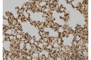 ABIN6276428 at 1/100 staining Rat lung tissue by IHC-P. (RAN antibody  (C-Term))