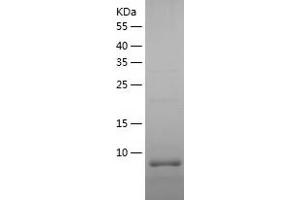 Western Blotting (WB) image for Metallothionein 4 (MT4) (AA 1-62) protein (His tag) (ABIN7286229) (MT4 Protein (AA 1-62) (His tag))