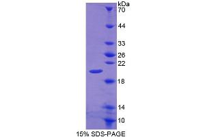 SDS-PAGE analysis of Rat CALY Protein. (CALY Protein)