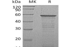 HCFC2 Protein (His tag)