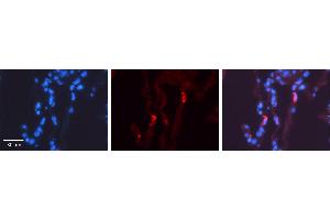 LMAN2 antibody - N-terminal region          Formalin Fixed Paraffin Embedded Tissue:  Human Lung Tissue    Observed Staining:  Cytoplasm of pneumocytes   Primary Antibody Concentration:  1:100    Other Working Concentrations:  1/600    Secondary Antibody:  Donkey anti-Rabbit-Cy3    Secondary Antibody Concentration:  1:200    Magnification:  20X    Exposure Time:  0.