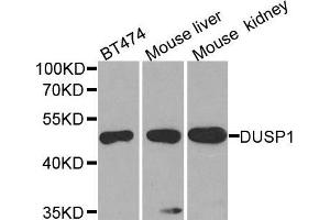 Western blot analysis of extracts of various cell lines, using DUSP1 antibody. (DUSP1 antibody)