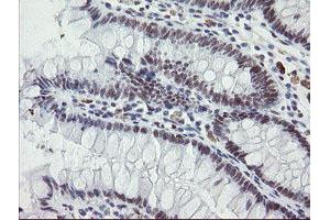 Immunohistochemical staining of paraffin-embedded Human colon tissue using anti-ZBED1 mouse monoclonal antibody. (ZBED1 antibody)