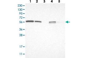 Western blot analysis of Lane 1: RT-4, Lane 2: U-251 MG, Lane 3: Human Plasma, Lane 4: Liver, Lane 5: Tonsil with LETM2 polyclonal antibody  at 1:250-1:500 dilution.