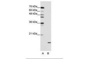 Image no. 2 for anti-Small Nuclear Ribonucleoprotein Polypeptide A (SNRPA) (AA 176-225) antibody (ABIN203017) (SNRPA1 antibody  (AA 176-225))